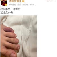 聚众斗殴：快手太原老葛活动浩南被打受伤，突袭者逃跑